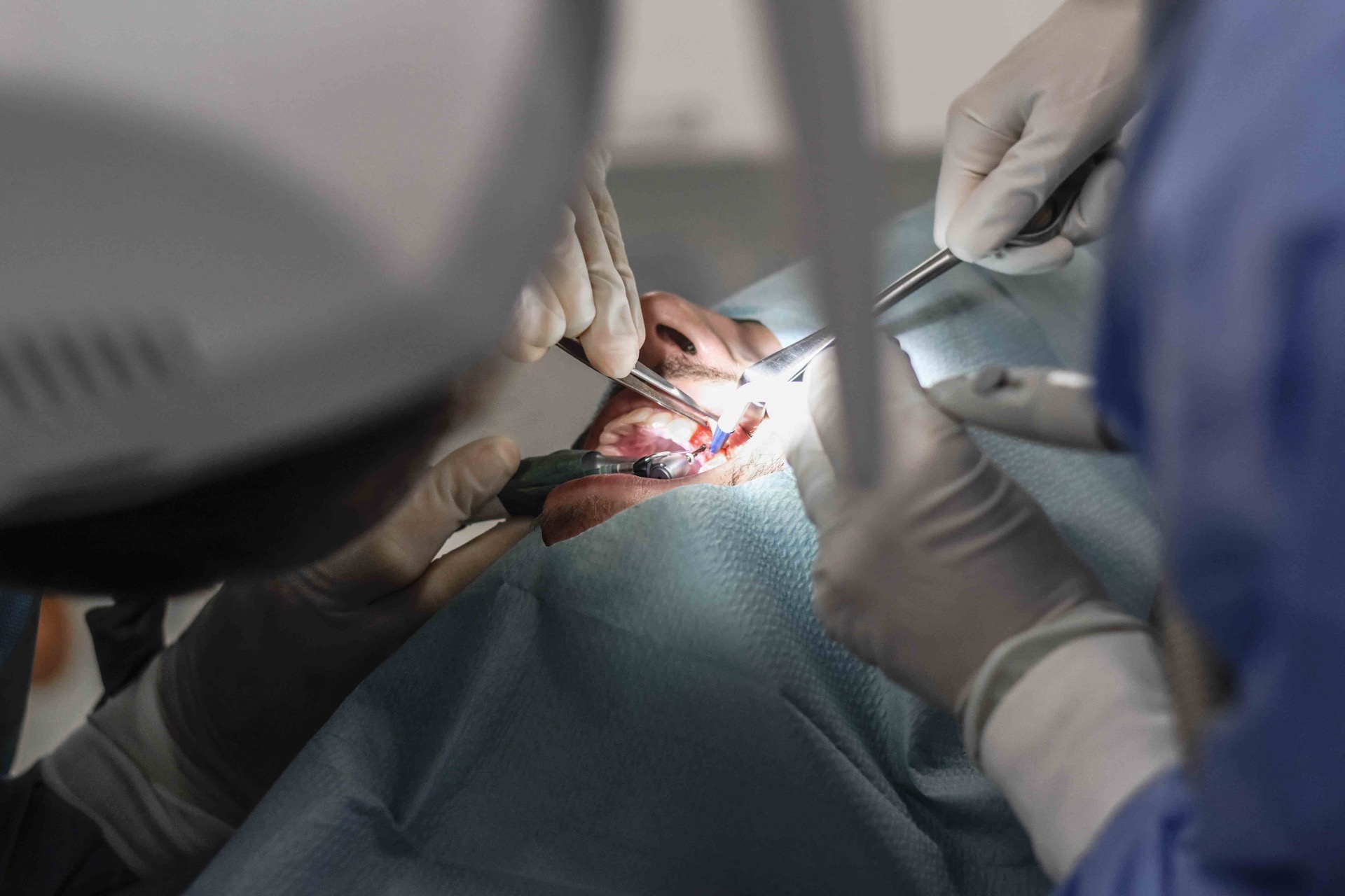 antrostomy