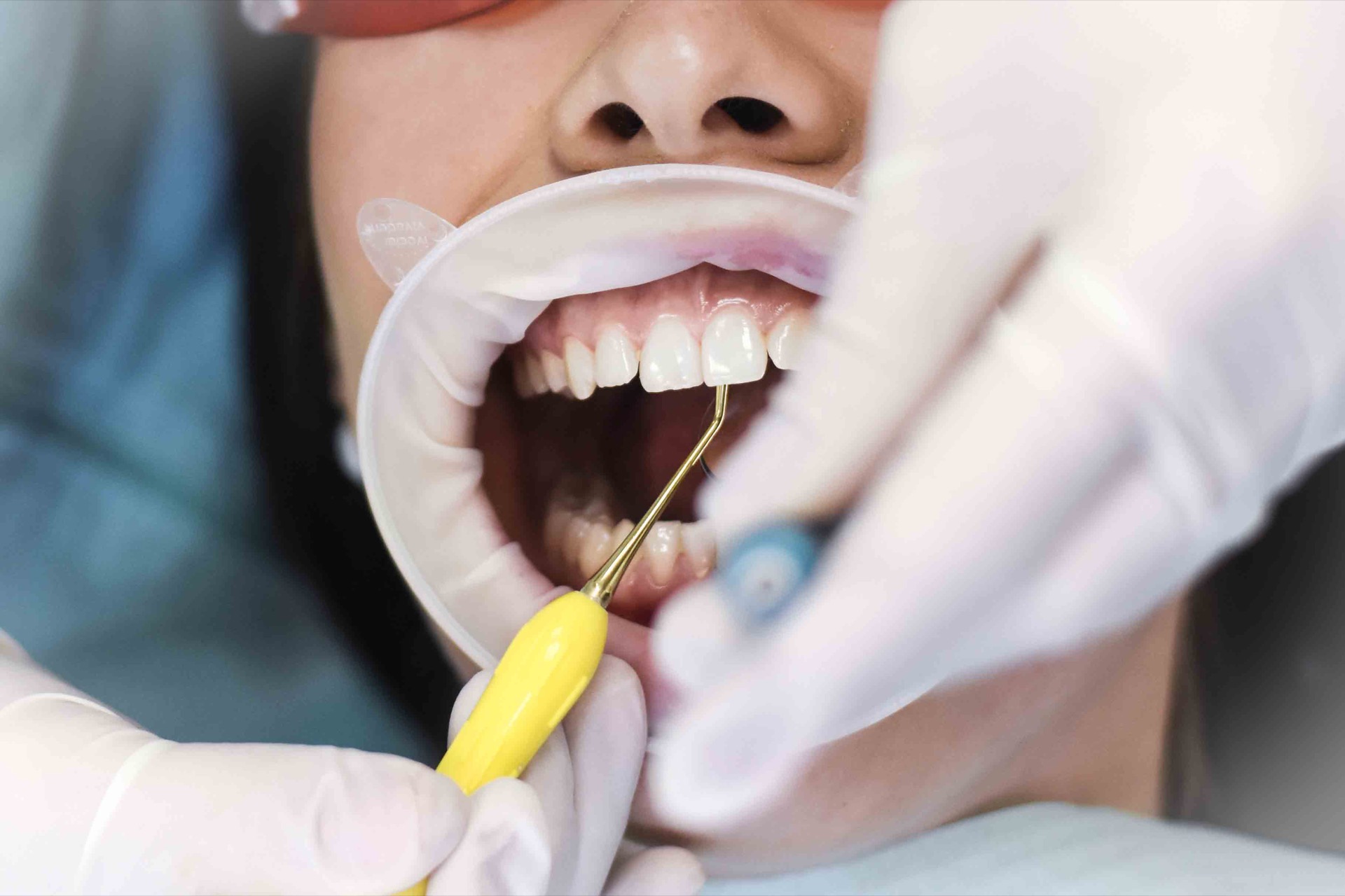 dental-hygiene