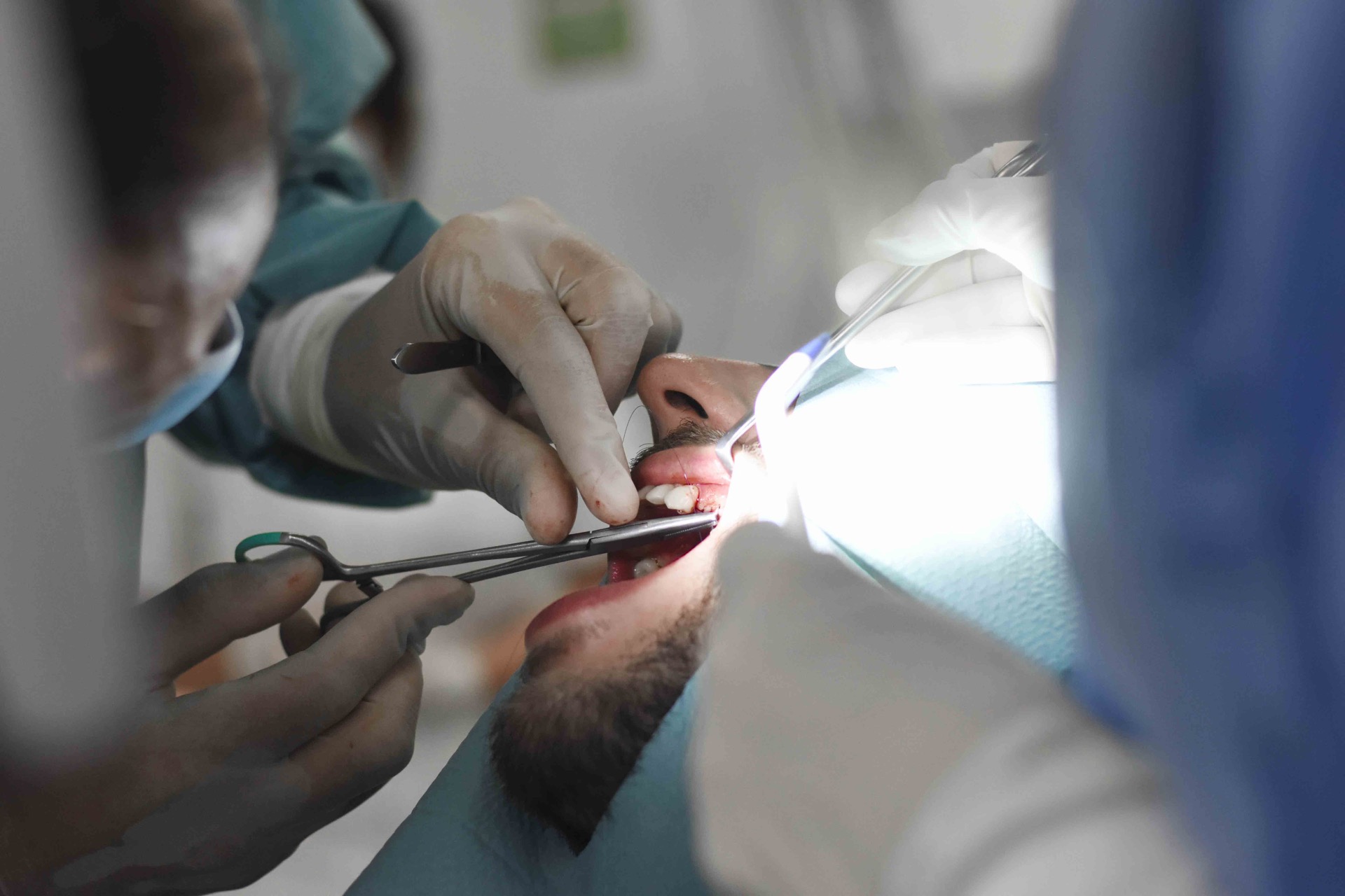 resection-root-tips