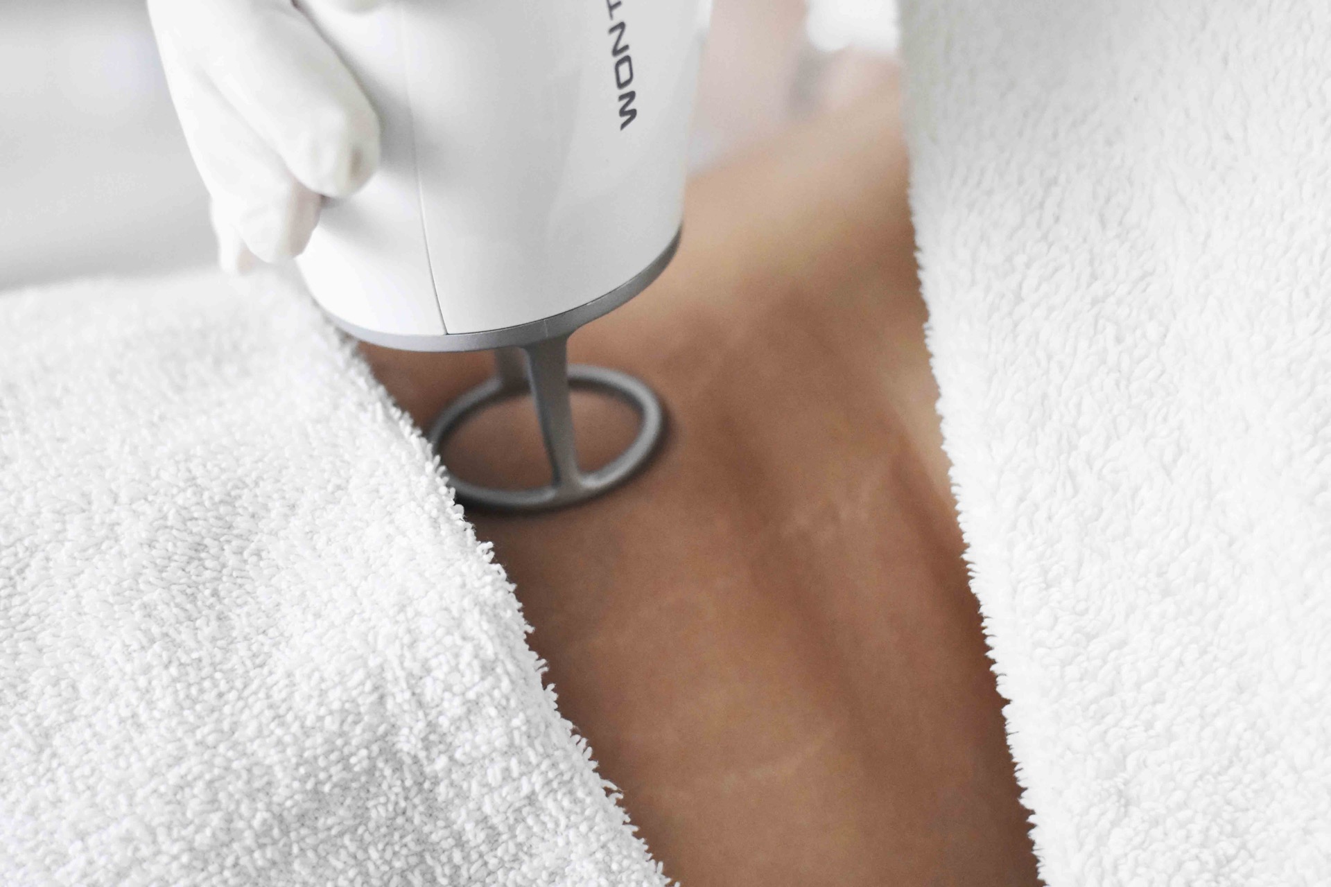 co2-laserovy-resurfacing-vrasky