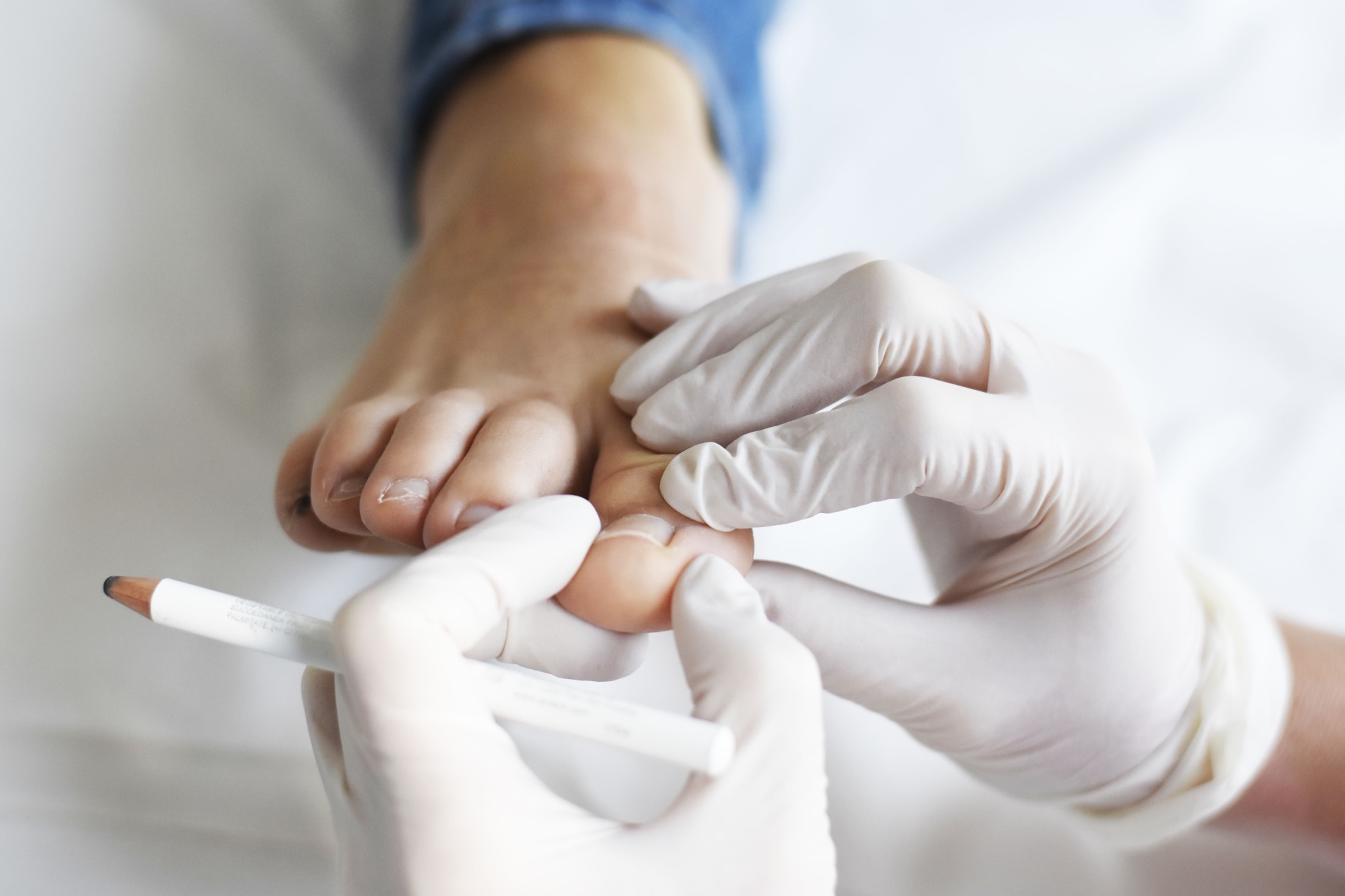 treatment-fungal-infections