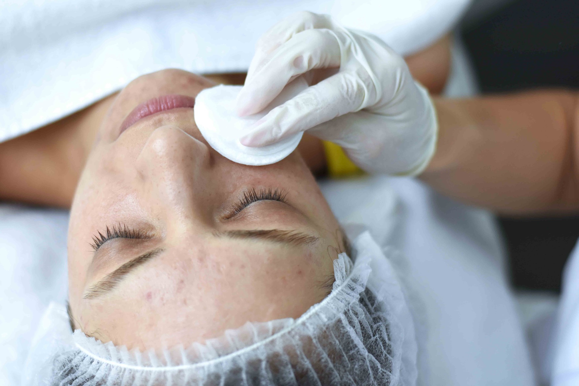 medicamentosa-treatment-acne
