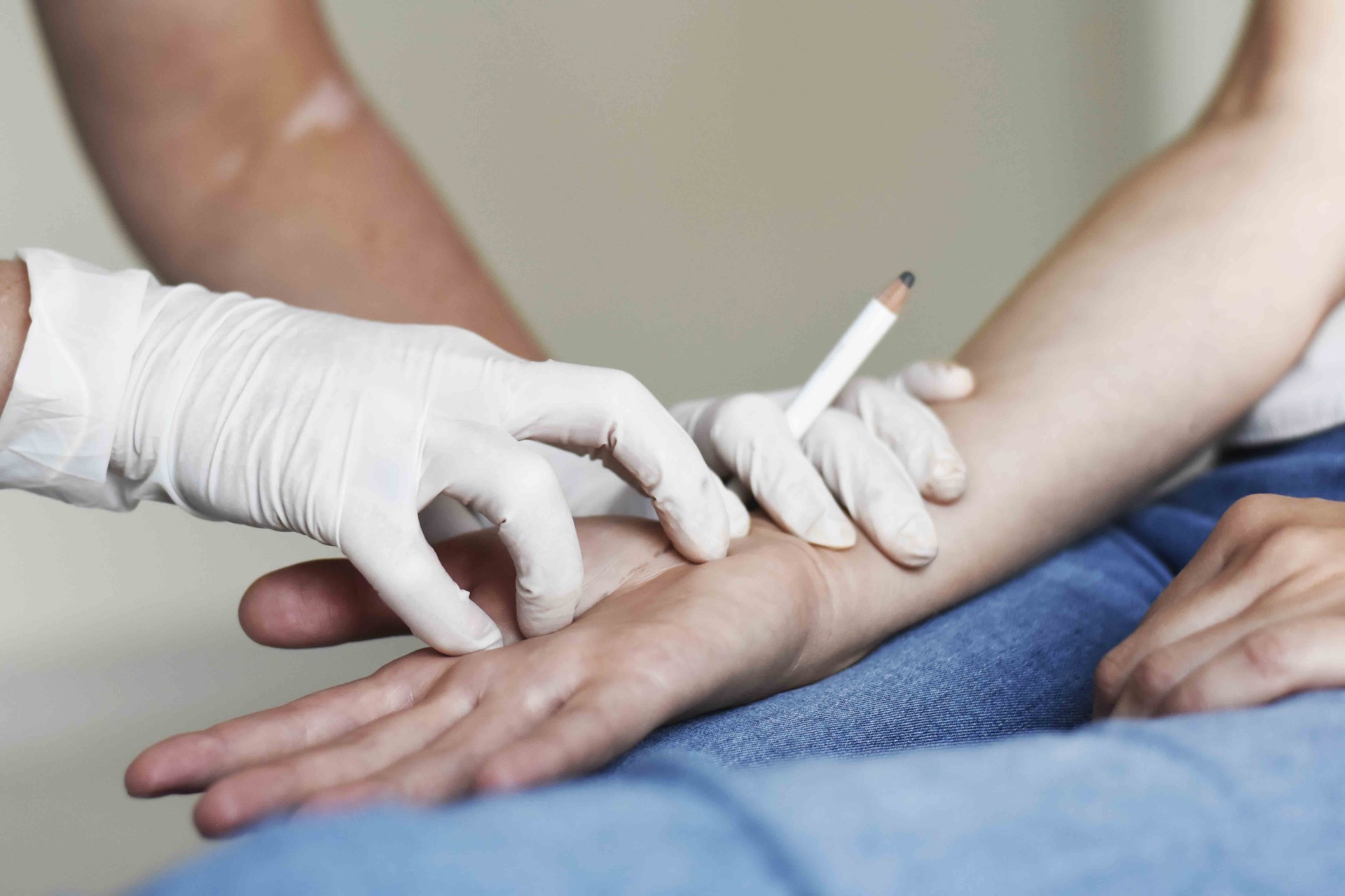 hand-surgery