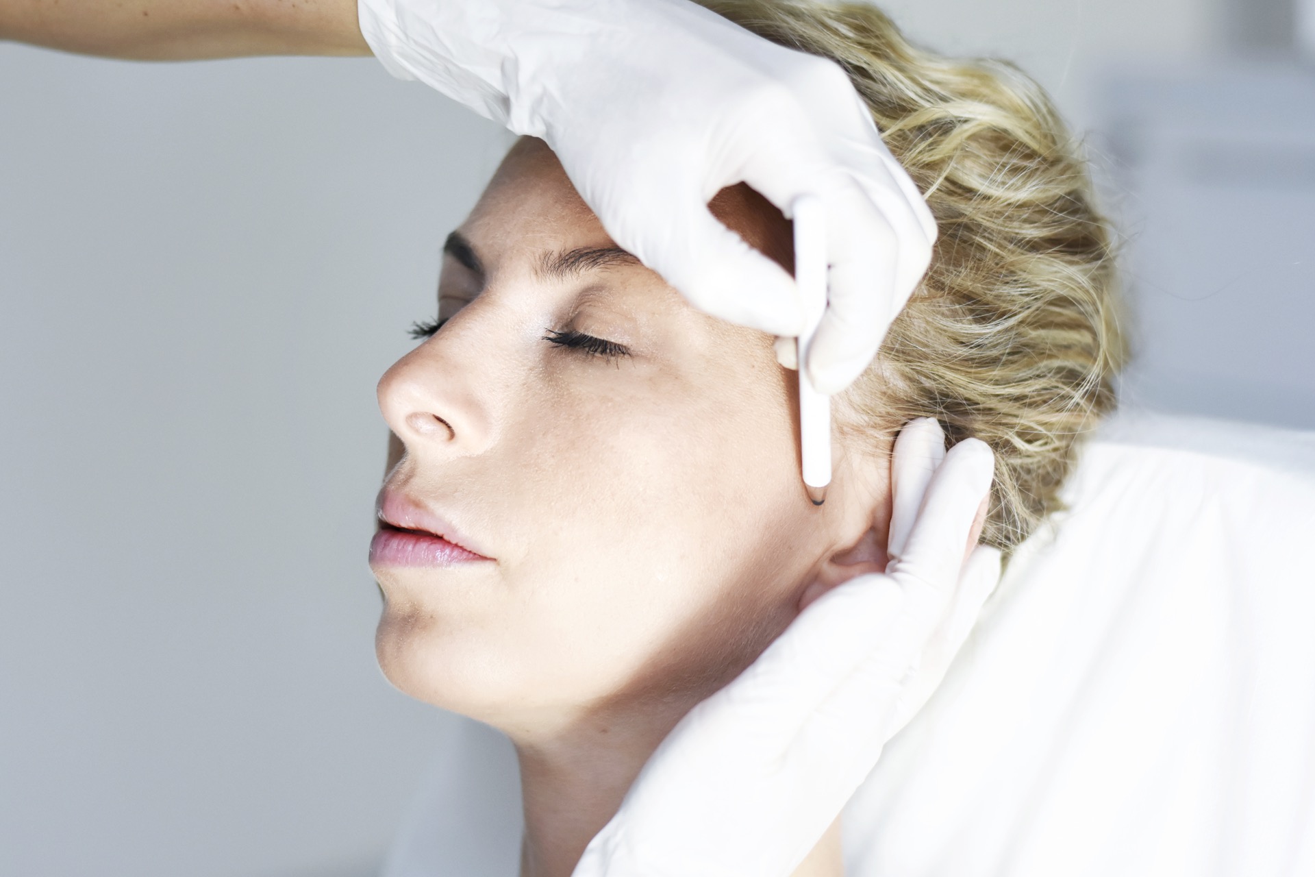 facelifting
