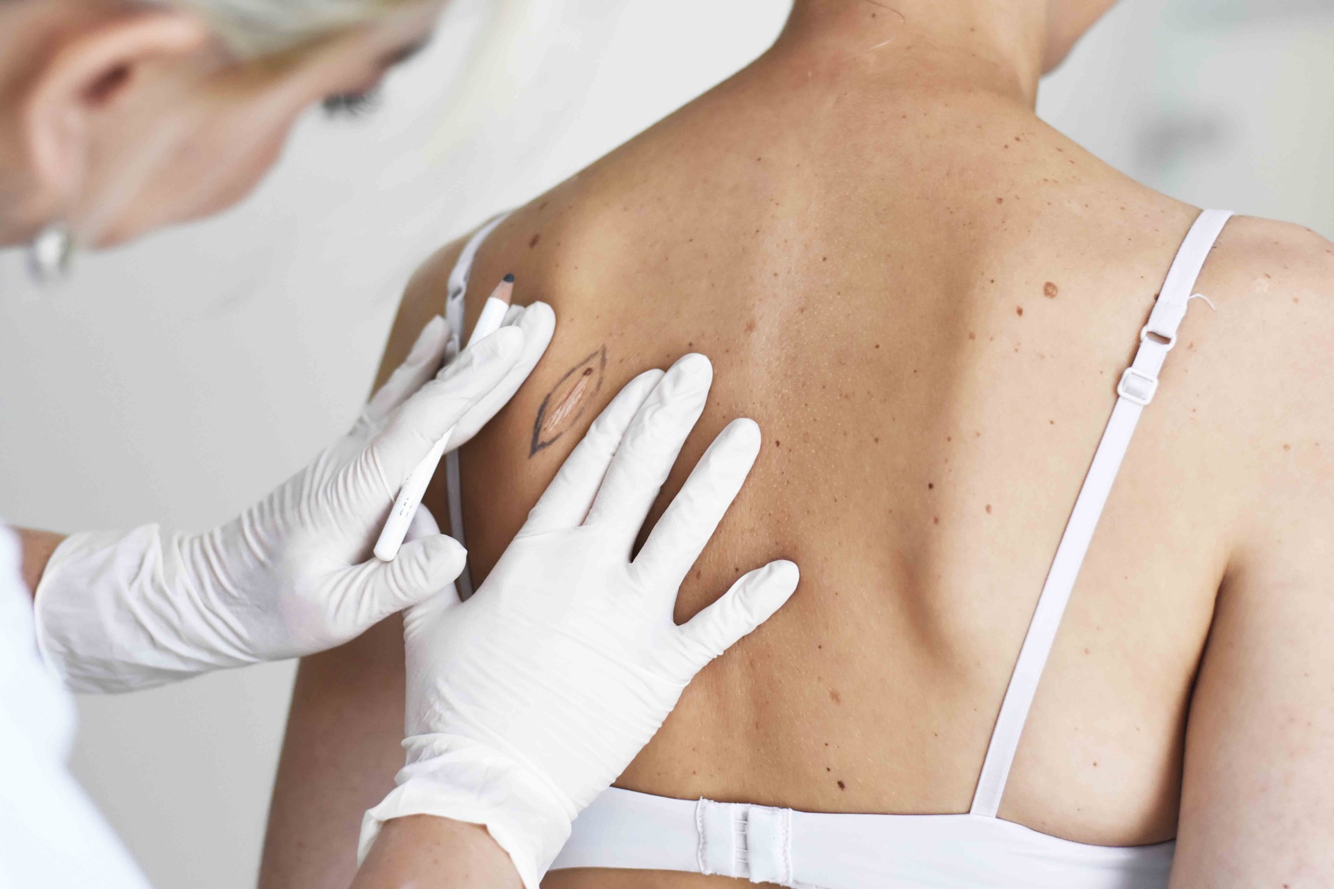 diprophos-scar-correction