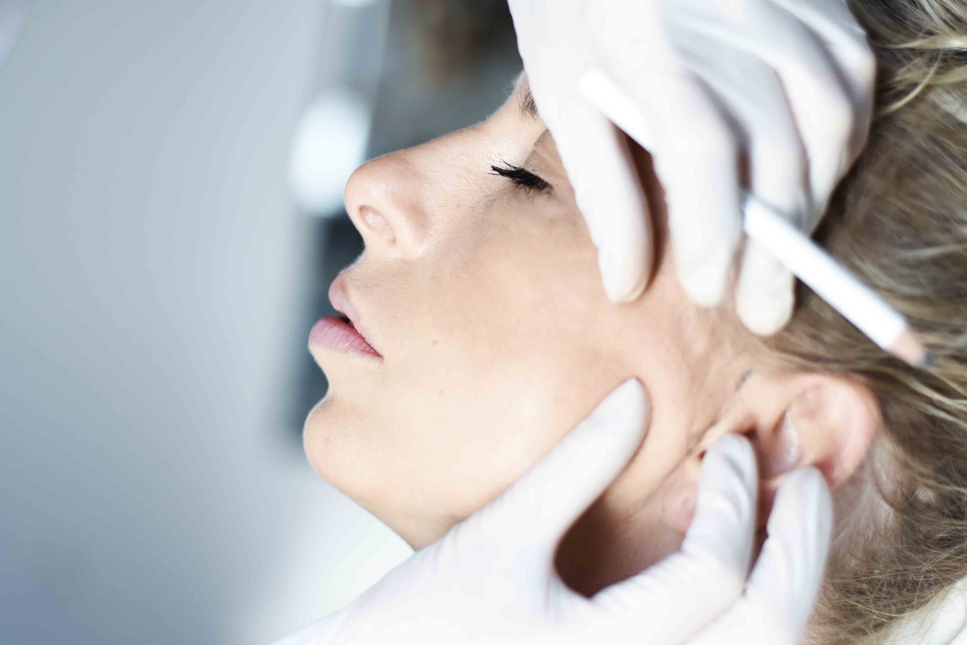 lipografting