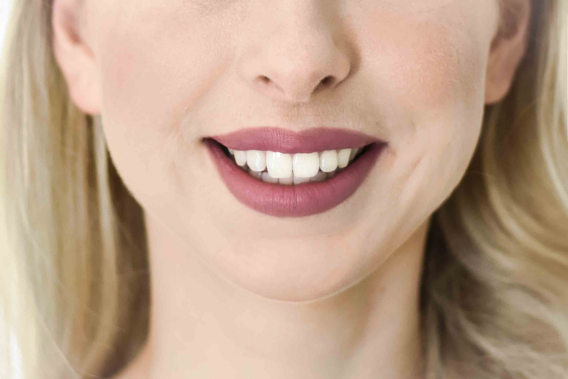 fillers-lips